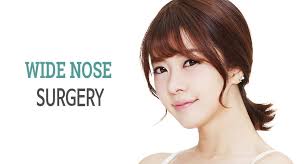 How to contour big nose detailed como contornear una nariz. Wide Nose Rhinoplasty Cost Korea Wide Nose Rhinoplasty Before And After Surgery Mine Clinic