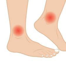 Persistent lumps or swollen glands. Leukemia Symptoms Early Signs Of Leukemia Leukemia Symptoms Network For Good Clay Cat Litter