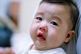 Un article de wikipédia, l'encyclopédie libre. Ce Bebe De Six Mois Decede Du Botulisme Apres Avoir Mange Du Miel