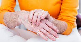 Unterschied Zwischen Arthrose Und Arthritis Focus Arztsuche