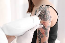 Can tattoo be removed by laser during pregnancy? How Long Does Redness Last After Laser Tattoo Removal Sk N Clinics