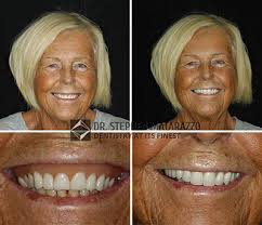 We did not find results for: Fountain Of Youth Dentures Quincy Ma Restore Your Natural Smile