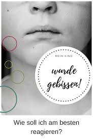 Mein Kind Wurde Gebissen Was Soll Ich Jetzt Tun Kinder Starke Kinder Und Erziehung