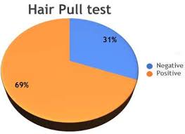 Image result for Hair Pull Test