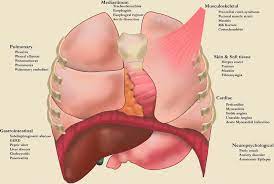 Give a differential diagnosis of retrosternal pain? Introductory Chapter The Patient Presenting With Chest Pain Intechopen
