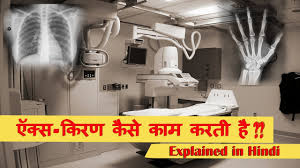 X Rays Explained In Very Simple Language Hindi Youtube