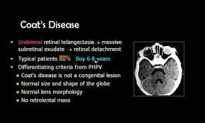 Coat S Disease Radiology Disease Head And Neck