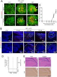 The best hunting, shooting and fishing | celebrate the outdoors | take part in nature Increased Abundance Of M Cells In The Gut Epithelium Dramatically Enhances Oral Prion Disease Susceptibility
