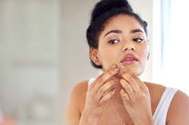There are various ways and methods to get rid of pimples, some are natural while others toxic (use of chemical and medicine). How To Get Rid Of Milia Causes Treatments From A Dermatologist