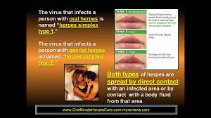 These unsightly blisters on your lip or mouth, sometimes called fever blisters, can take a week or more to clear up on their own. How Long Does The Genital Herpes Outbreak Last Youtube