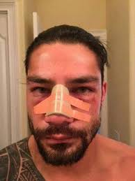 Do you love Roman Reigns?