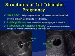 You won't get any results at the time of the scan. How Soon Can An Ultrasound Confirm Your Pregnancy Quora
