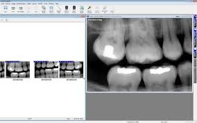 Dental Charting Software Maxident Digital Charting