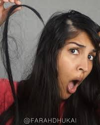 Farah Dhukai On Instagram Grow Hair Back In Bald Spots I Get Traction Alopecia Aka Ran In 2020 Grow Hair Back Grow Hair Protective Hairstyles For Natural Hair