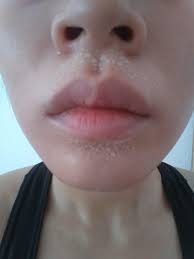 Aloe also contains vitamins, minerals and enzymes that rebuild your skin at cellular level—which means you'll actually feel rejuvenated while using this sunscreen. Sun Care Review Post Workout Sweatstache Brought To You By Australian Gold Botanical Spf50 Skincareaddiction