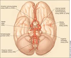 5 / 5 8 мнений. Intracranial Aneurysms Current Evidence And Clinical Practice American Family Physician