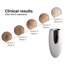 Unfortunately, none of these treatments take out all of the hair follicles in one shot, so you'll need. Ipl Machine For Home Use Best Laser Hair Removal Kit Light Face Facial Spa At Okay Zhuhai Electronic Technology Co Ltd Beautetrade