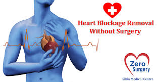 Bypass Surgery Cost In India Is Lower Than In The Western Countries But By Indian Standard It Is Still Very High Bypass Surgery Heart Treatment Heart Blockage