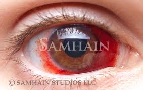 Hemorrhage Ii Single Lens Samhain Contact Lenses Chuck silva 4.061 views6 year ago. hemorrhage ii single lens