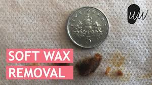 Soft Olive Oil Infused Ear Wax Removal 364 Youtube