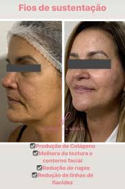 Dra Priscilla Barross