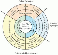 Image result for Syncope