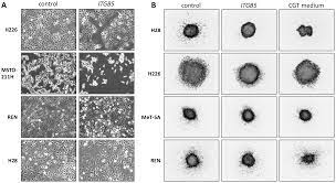 To describe an unusual occupational asbestos exposure in a patient with mesothelioma. Plos One Cilengitide Inhibits Attachment And Invasion Of Malignant Pleural Mesothelioma Cells Through Antagonism Of Integrins Avb3 And Avb5