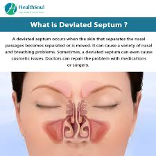 The nasal septum bone and cartilage are covered by a special skin called a mucous membrane that has many blood vessels in it. Deviated Nasal Septum Causes And Treatment Healthsoul