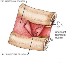 Image result for Thoracentesis