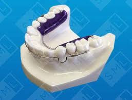 These gentle forces are active over a very large. Inman Aligner Sml