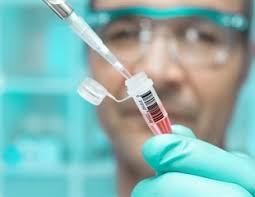 Marburg virus (marv) causes marburg virus disease in humans and nonhuman primates, a form of viral hemorrhagic fever. Marburg Virus News Research