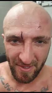 Another day in the office 😉👊☘️ #bkfc #bkfcuk #bareknuckle #boxing #bk  #Leeds #Ireland #UK #victory #more #battlescars #fyp