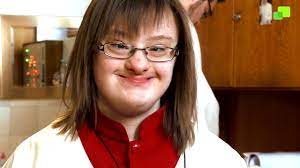 Down syndrome (trisomy 21) is a common chromosomal disorder producing physical and developmental effects. Franziska Ministrantin Mit Down Syndrom Doku Girl Altar Server Leben Mit Inklusion Youtube