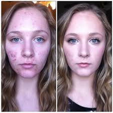 Résultat de recherche d'images pour "makeup before and after"