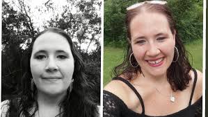 Fundraiser by Elizabeth Goodman : Skin Removal Surgery