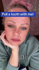 How to Pull A Loose Tooth If Its Stuck