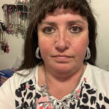 Does anyone have any experience with Yorkie dental problems? Second round  of shots for my male puppy and the vet says he may have to have dental  surgery 😔 (He will check