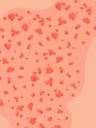 Orange spots on hands when cold. Skin Rash 9 Questions That Will Help You Decode That Skin Rash Self