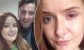 This suitable tutorial explains exactly how it's done, and will help you get good at personal hygiene,. Student Accidentally Ripped Out Cornea After Leaving Contact Lenses In For 10 Hours Express Co Uk