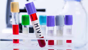 Ob, wann und in welcher form ein infizierter an aids erkrankt, lässt sich im einzelfall kaum voraussagen. 40 Jahre Aids Wie Weit Ist Die Forschung Zu Hiv Forschung Lehre