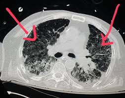 Pin On Ct Scans