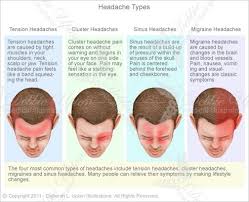 Headache Types Debbieupton Com Migraines Remedies Headache Types Natural Headache Remedies