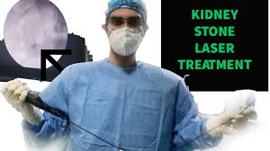 Kidney Stone Treatment In Delhi Blue Ribbon Prostate Clinic