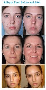 Pin On Skincare