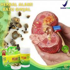 Kesan pada masa akan dtg. Pelvifit Obat Mencegah Gagal Ginjal Batu Ginjal Batu Empedu Batu Kandung Kemih Sakit Pinggang Shopee Indonesia