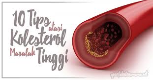 Kolesterol yang baik amat penting bagi kesihatan jantung anda, tidak seperti kolesterol jahat yang boleh meningkatkan risiko sakit jantung. 10 Tips Cara Mengatasi Kolesterol Tinggi Elak Risiko Serangan Jantung Stroke