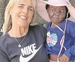 Camp Bush Baby gets to celebrate their 10th birthday with a bash