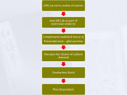 guillain barre syndrome