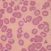 Red blood cells are also known as rbcs or erythrocytes (from greek erythros for red and kytos for hollow. Https Encrypted Tbn0 Gstatic Com Images Q Tbn And9gctlwpqau3k853hs60hcfec4vamggpslxp 3ezawtf3cavrxzjwj Usqp Cau