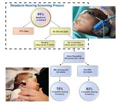 Image result for Pediatric Auditory Screening